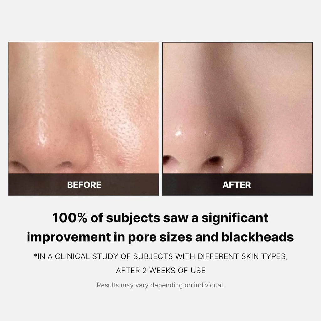 Medicube - Zero Pore Pad 2.0 70pcs